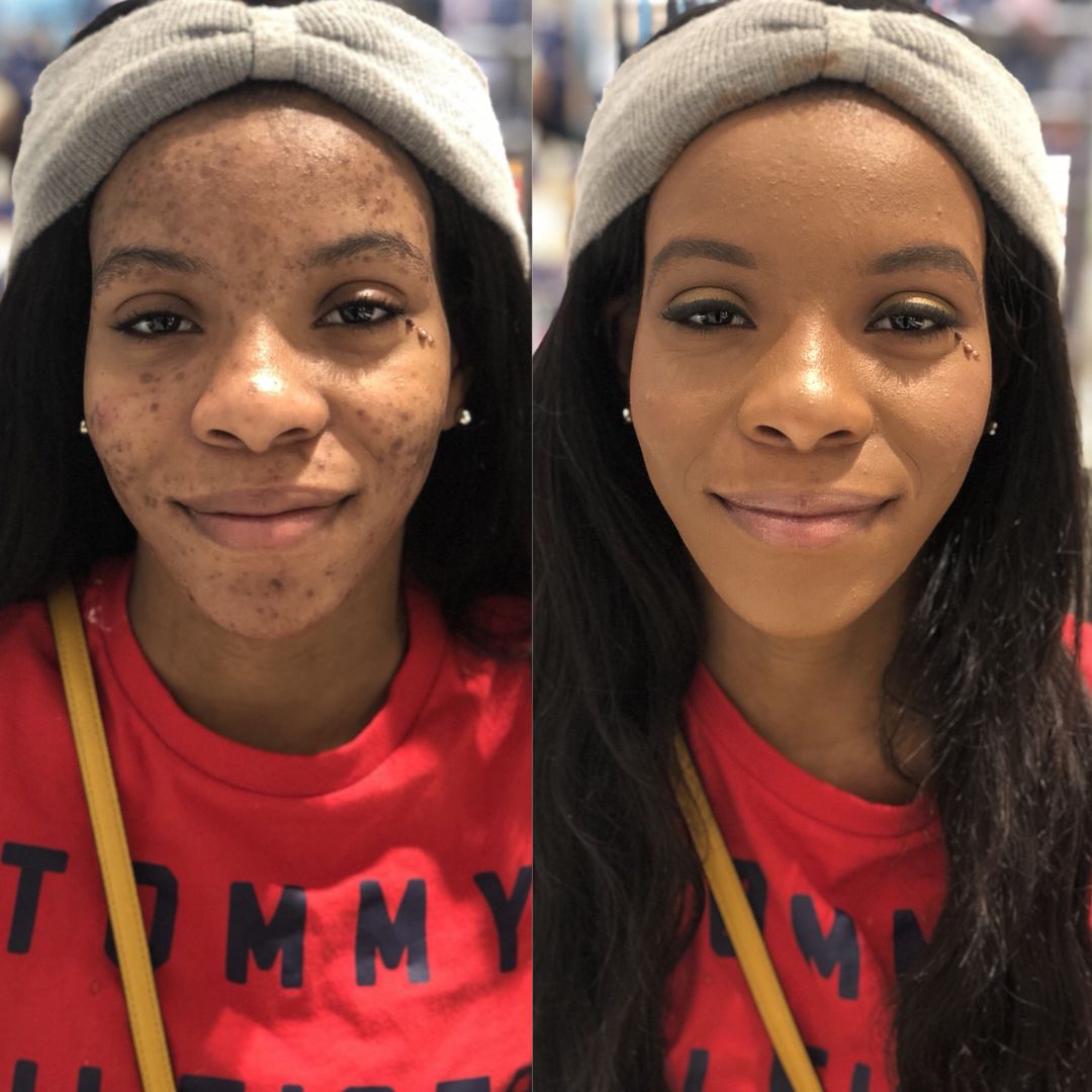 Akosua — before and after 6 weeks