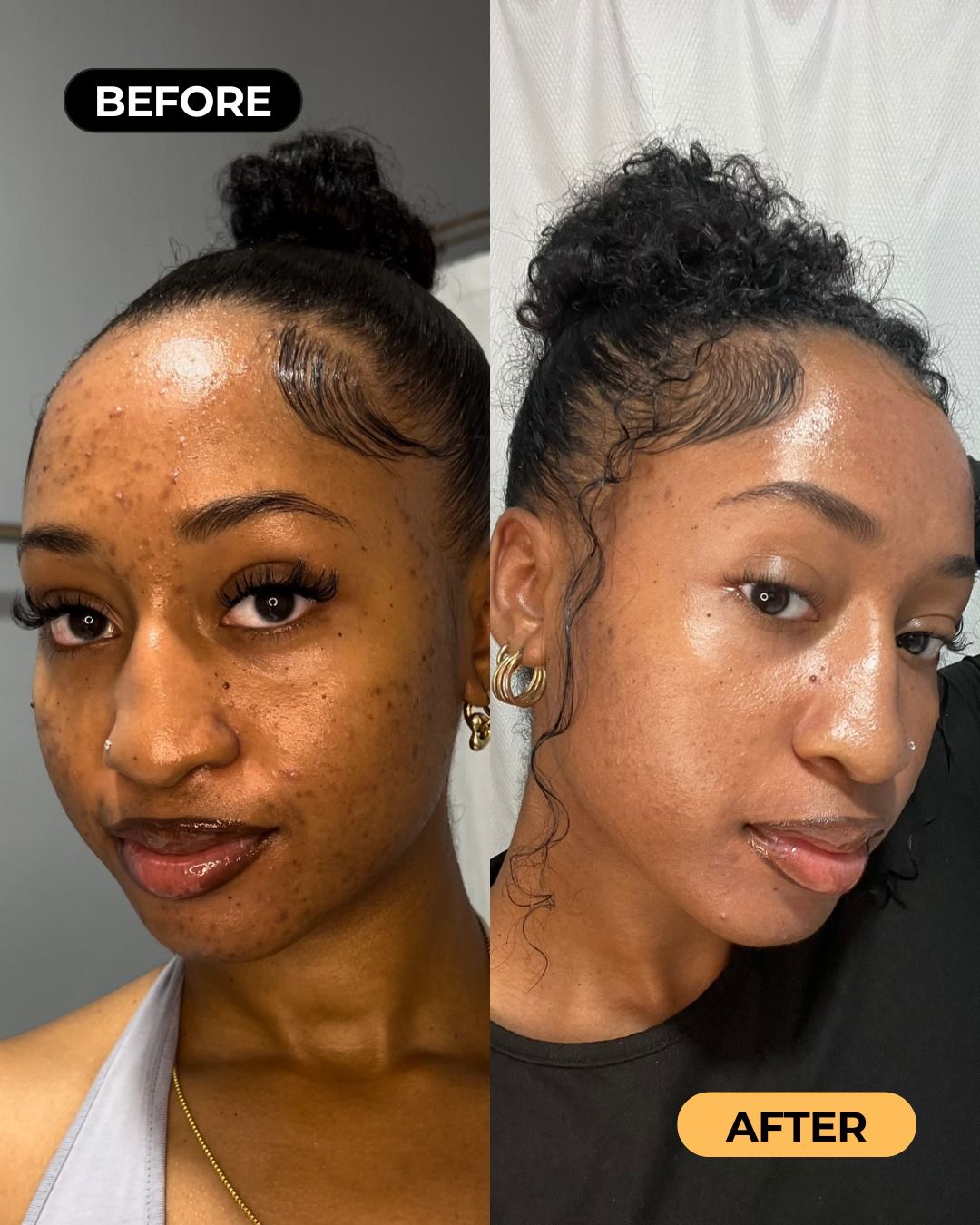 Ngozi — before and after 8 weeks