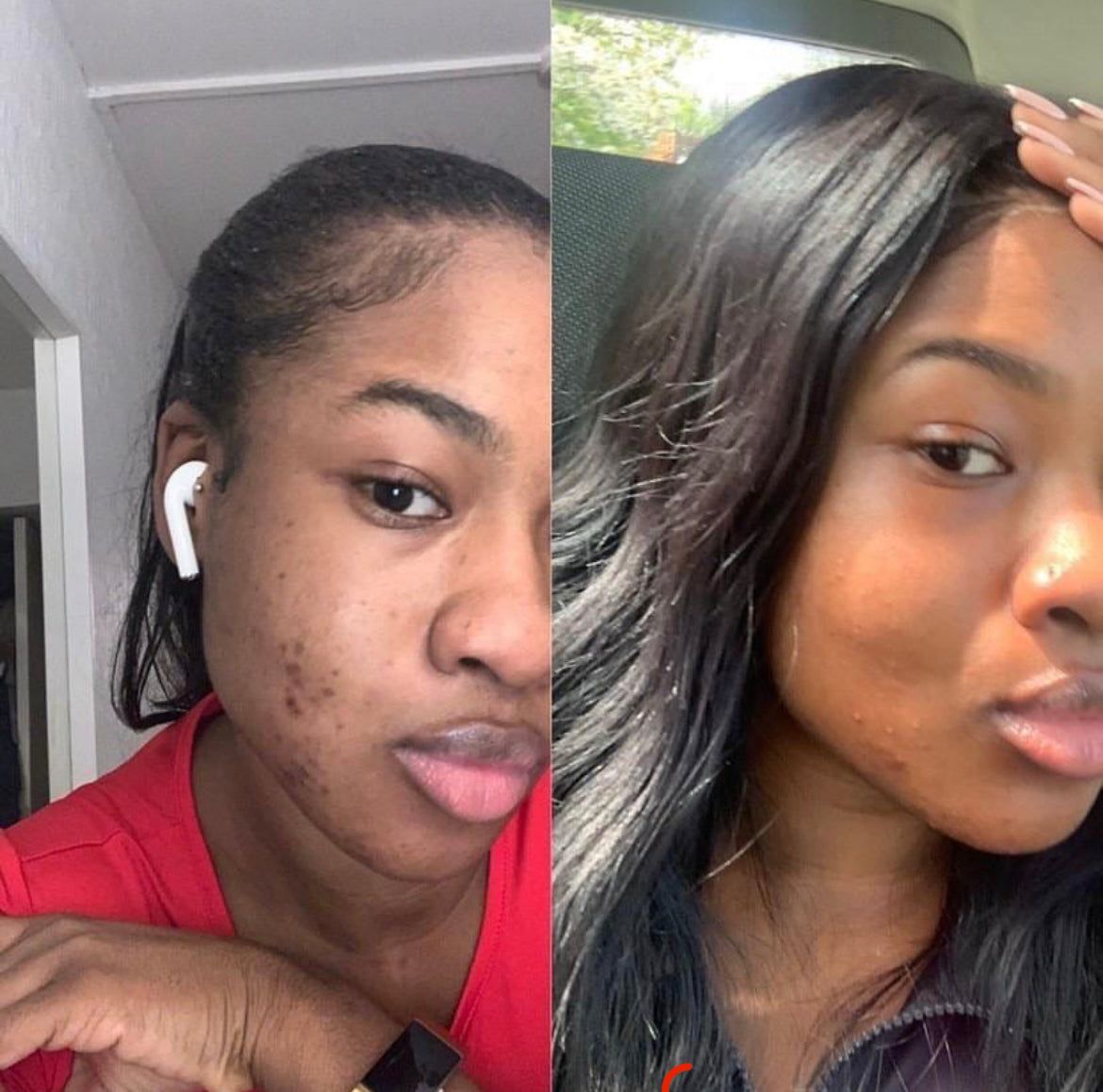 Chioma — before and after 6 weeks